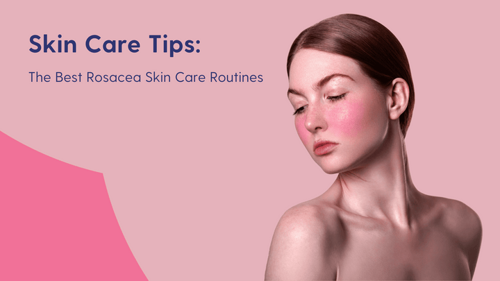 Best rosacea skin care routines