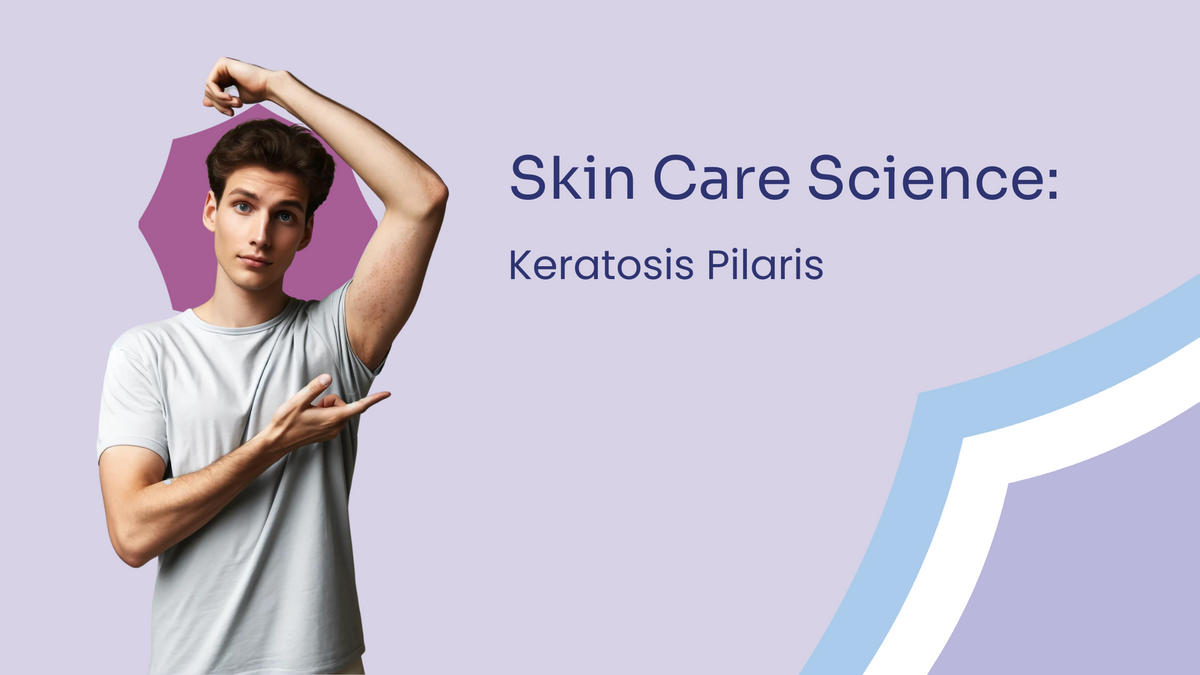 The Science Of Keratosis Pilaris Chicken Skin Skin Type Solutions