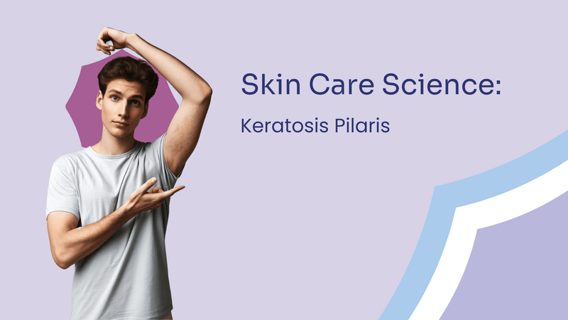 Keratosis pilaris