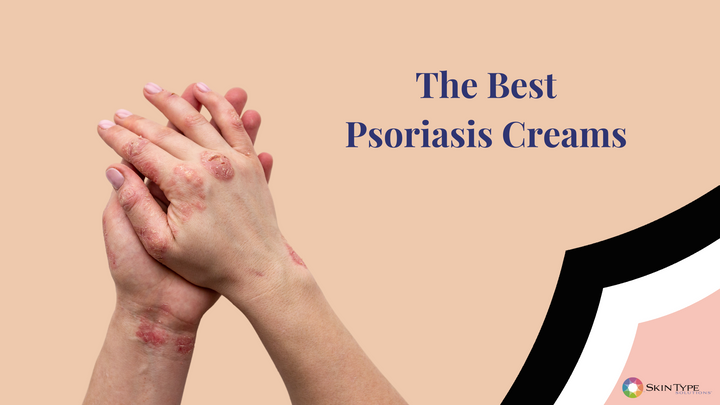 Psoriasis creams soothe skin while waiting for prescription medications to take effect.