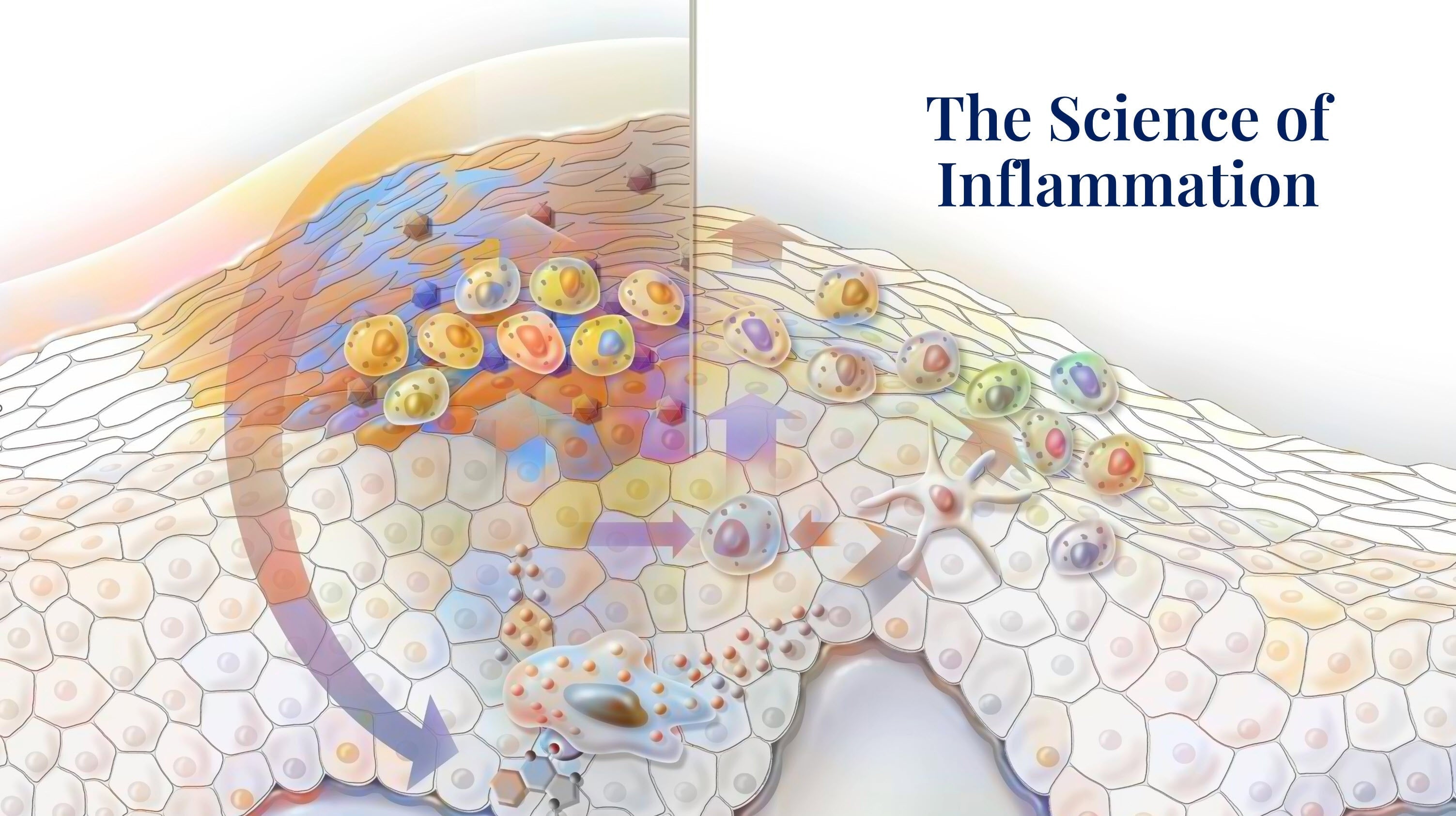 Skin Inflammatory Process The Science of Skin Inflammation | Skin Care – Skin Type Solutions
