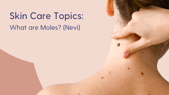 What are moles