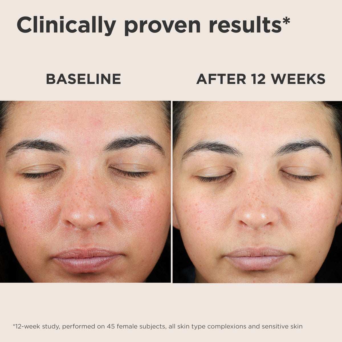 EltaMD Face & Body Sunscreen EltaMD UV Skin Recovery Broad Spectrum SPF 50 Face Sunscreen - Skin Type Solutions