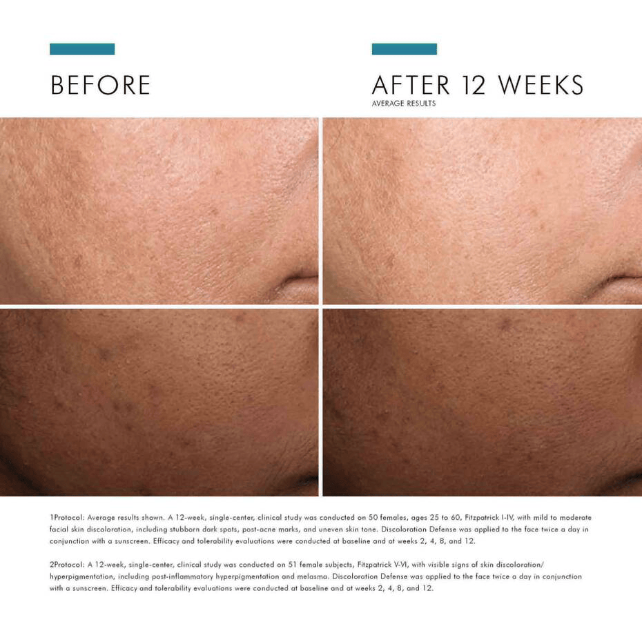 SkinCeuticals Facial Treatment 1.0 fl. oz. SkinCeuticals Discoloration Defense - Skin Type Solutions