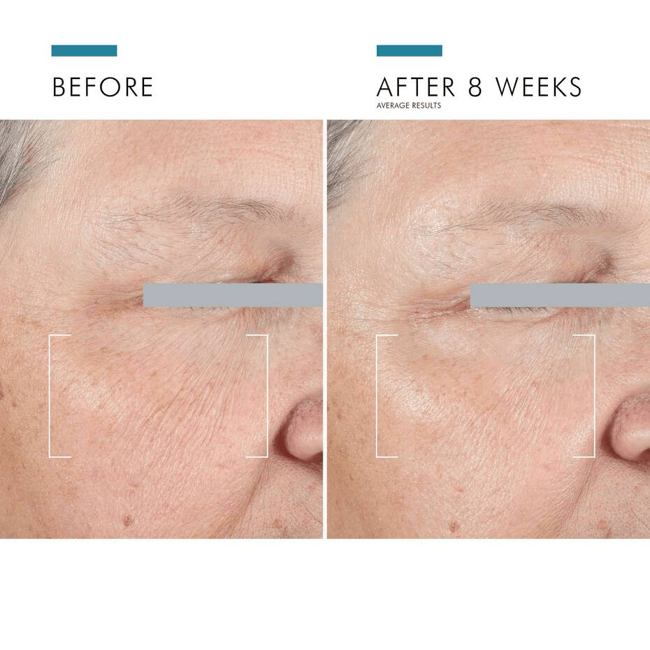 SkinCeuticals Eye Treatment 0.5 oz. SkinCeuticals A.G.E Advanced Eye - Skin Type Solutions