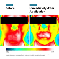 SkinCeuticals Post Procedure Wound Healing 1.0 fl. oz. SkinCeuticals Phyto Corrective Hydrating + Calming Gel Serum - Skin Type Solutions