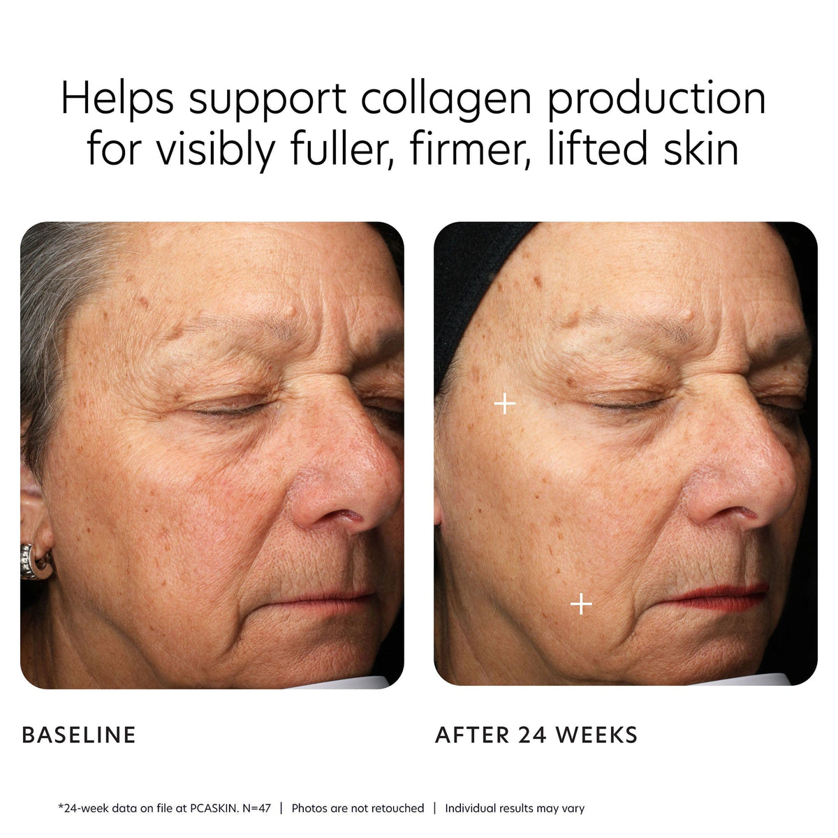 PCA Skin Face Moisturizers PCA Skin MGF Age Renewal Cream - Skin Type Solutions