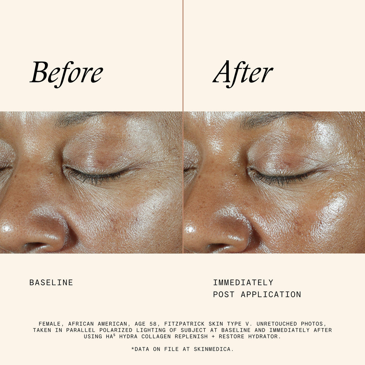 SkinMedica Face Moisturizers SkinMedica HA5 Hydra Collagen Replenish + Restore Hydrator - Skin Type Solutions