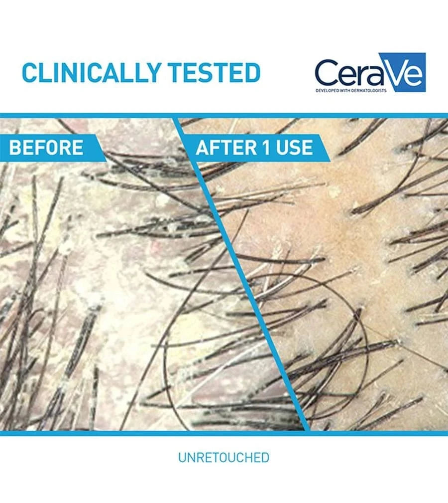 Cerave CeraVe 2-in-1 Anti-Dandruff Hydrating Shampoo and Conditioner - Skin Type Solutions