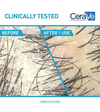 CeraVe 2-in-1 Anti-Dandruff Hydrating Shampoo and Conditioner