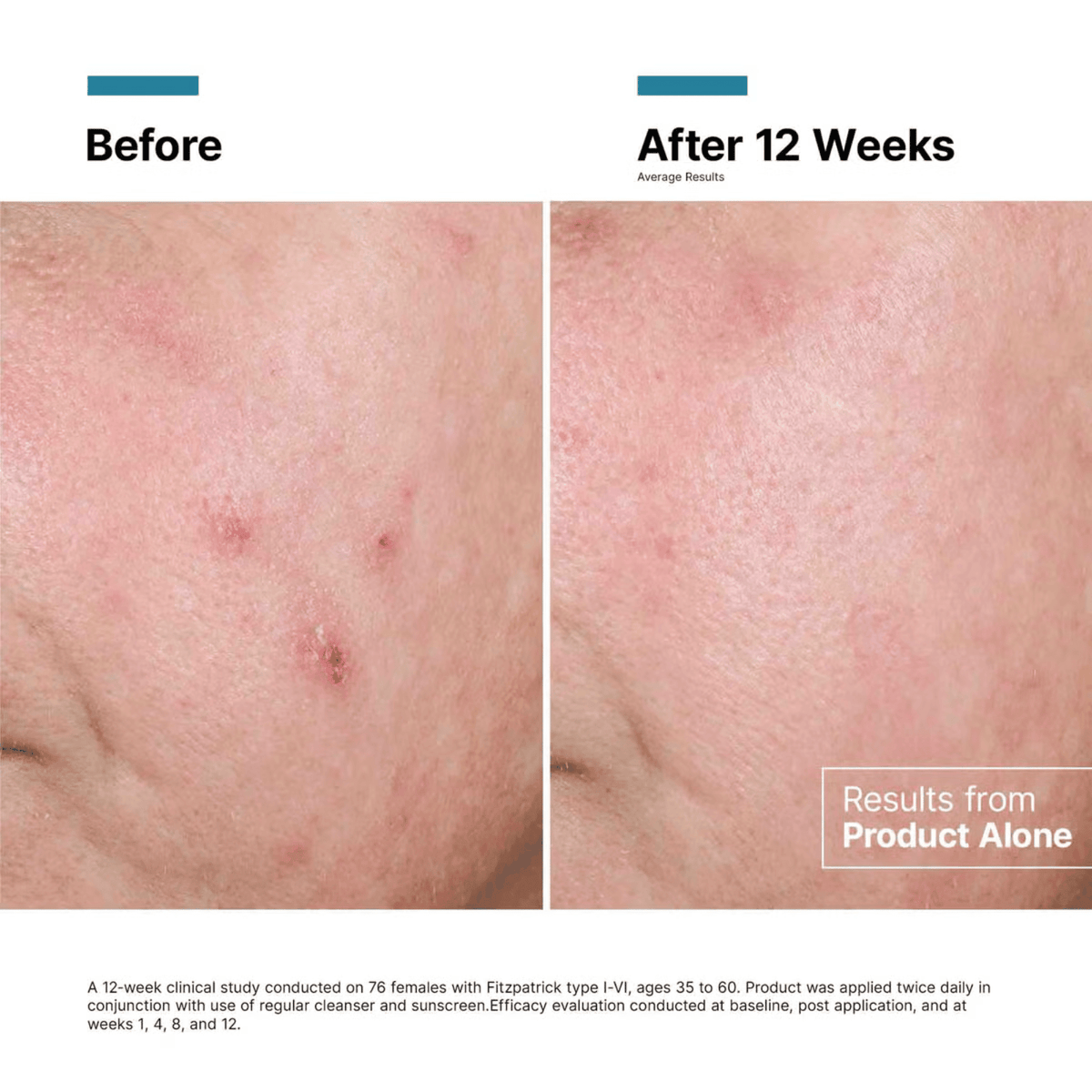 SkinCeuticals SkinCeuticals Advanced RGN-6 - Skin Type Solutions