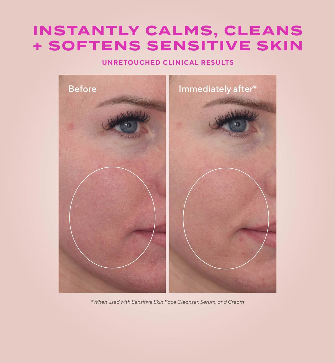 Murad Face & Body Cleansers Murad Heartleaf Soothing Face Cleanser - Skin Type Solutions
