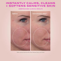 Murad Face & Body Cleansers Murad Heartleaf Soothing Face Cleanser - Skin Type Solutions