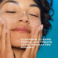 Murad Face & Body Cleansers Murad Acne Control Clarifying Cleanser - Skin Type Solutions