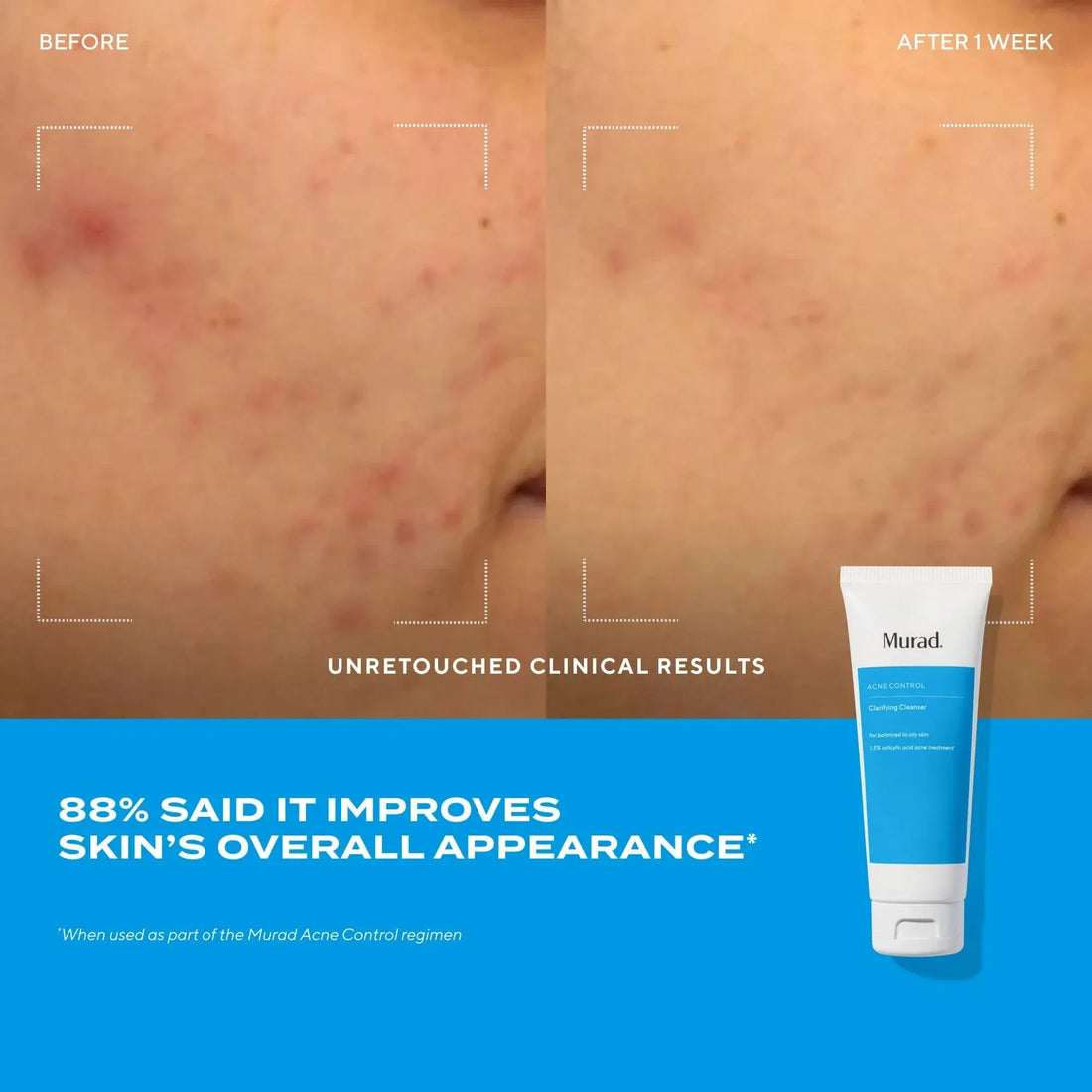 Murad Face & Body Cleansers Murad Acne Control Clarifying Cleanser - Skin Type Solutions