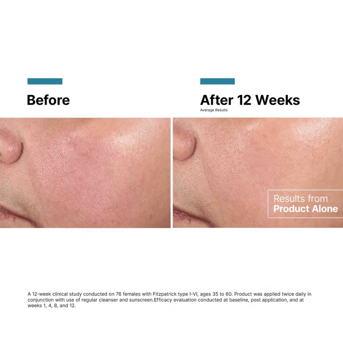 SkinCeuticals SkinCeuticals Advanced RGN-6 - Skin Type Solutions