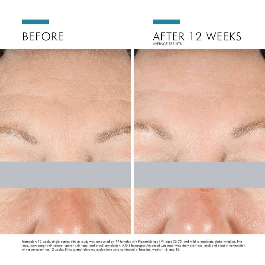 SkinCeuticals Facial Moisturizer 1.7 oz. SkinCeuticals A.G.E Interrupter Advanced - Skin Type Solutions