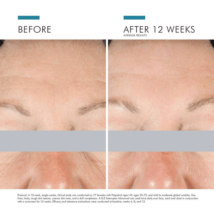 SkinCeuticals A.G.E Interrupter Advanced – Skin Type Solutions
