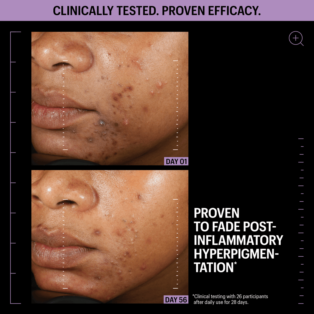 Allies Of Skin Treatments & Serums Allies of Skin Azelaic and Kojic Advanced Clarifying Serum - Skin Type Solutions