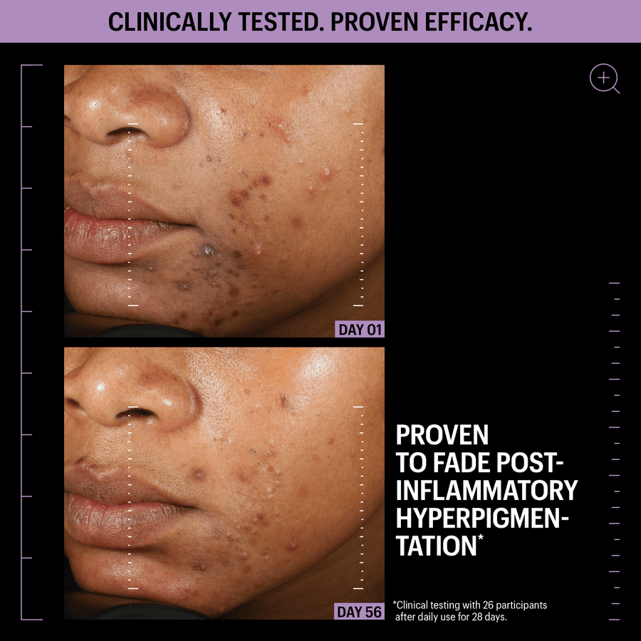 Allies Of Skin Treatments & Serums Allies of Skin Azelaic and Kojic Advanced Clarifying Serum - Skin Type Solutions