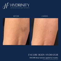 Hydrinity Treatments & Serums Hydrinity ENCORE Body Hydrator - Skin Type Solutions