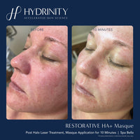 Hydrinity Eye Patch/Mask Hydrinity Restorative HA+ Masque (5 masques) - Skin Type Solutions