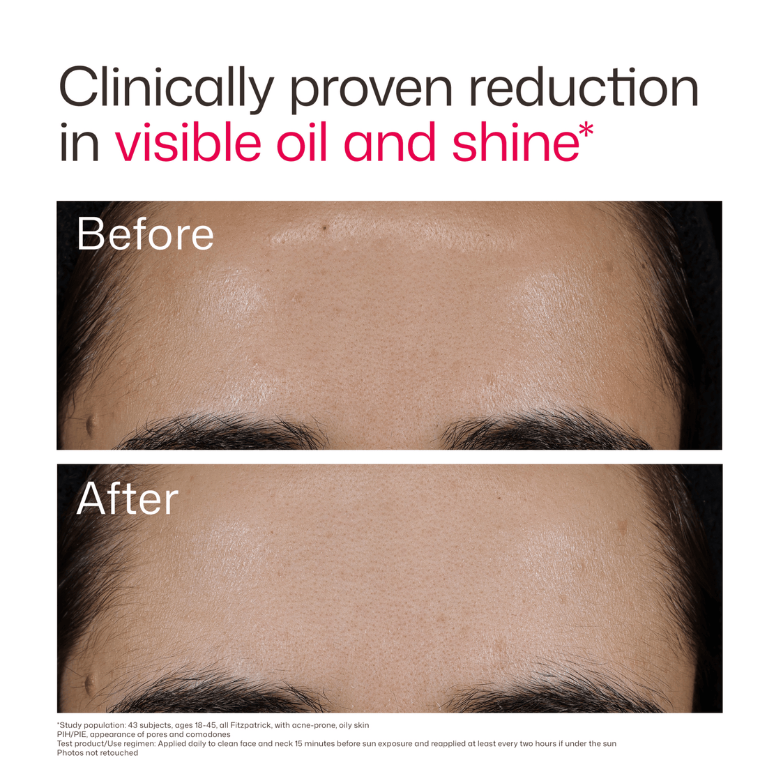 EltaMD Sunscreen EltaMD UV Clear Acne Blemish-Prone & Oil Balancing SPF 50 - Skin Type Solutions