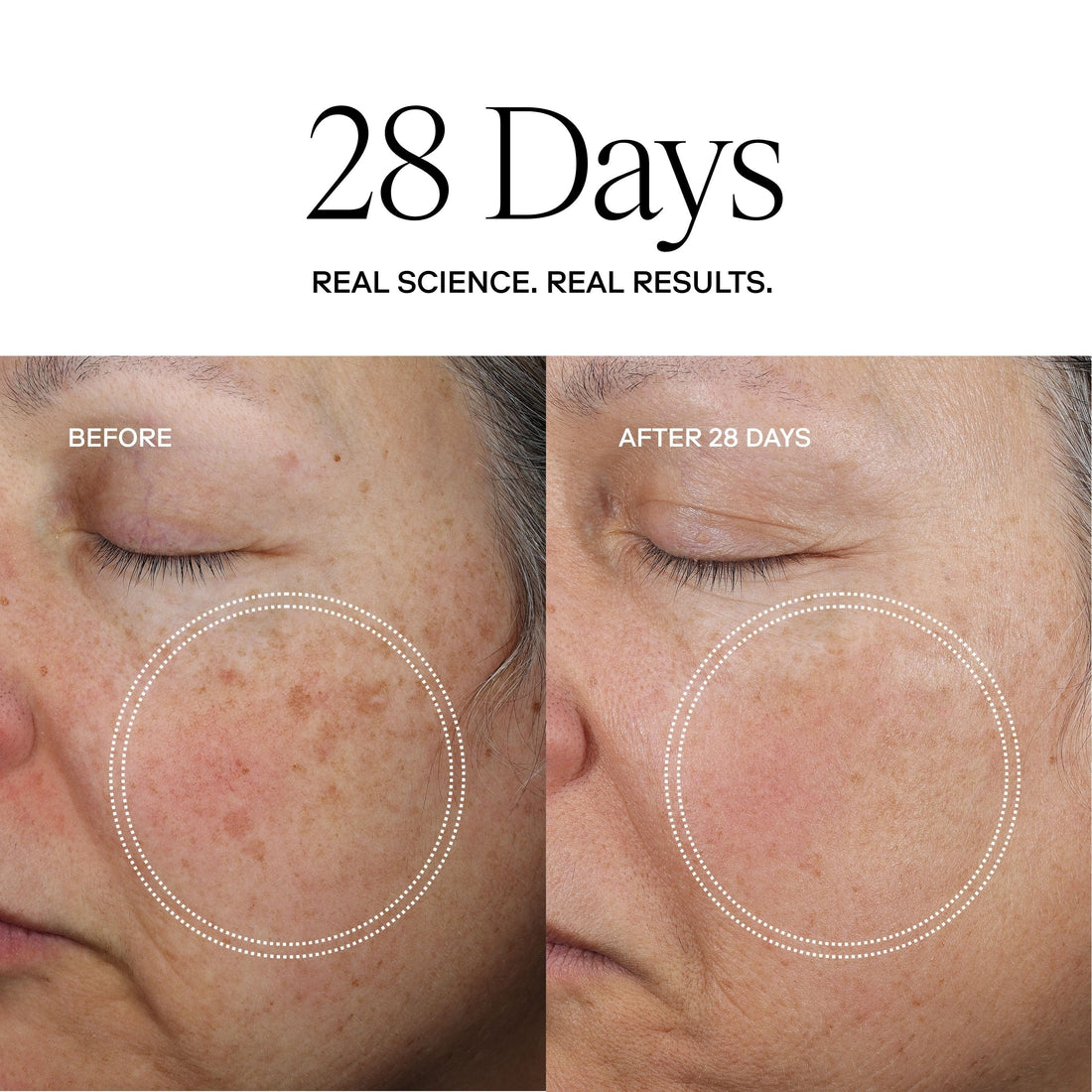 Exoceuticals Face Moisturizers Exoceuticals Exo Face Perfection Moisturizer - Skin Type Solutions