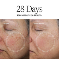 Exoceuticals Face Moisturizers Exoceuticals Exo Face Perfection Moisturizer - Skin Type Solutions
