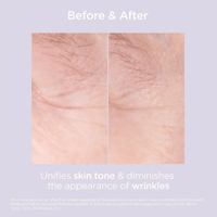 ISDIN Facial Treatment 1.7 oz. ISDIN Glicoisdin 15 Moderate Exfoliating Glycolic Acid Face Gel - Skin Type Solutions