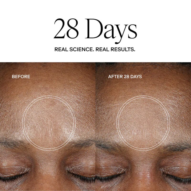 Exoceuticals Treatments & Serums Exoceuticals H-Serum Hyaluronic Acid Treatment - Skin Type Solutions