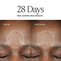 Exoceuticals Treatments & Serums Exoceuticals H-Serum Hyaluronic Acid Treatment - Skin Type Solutions