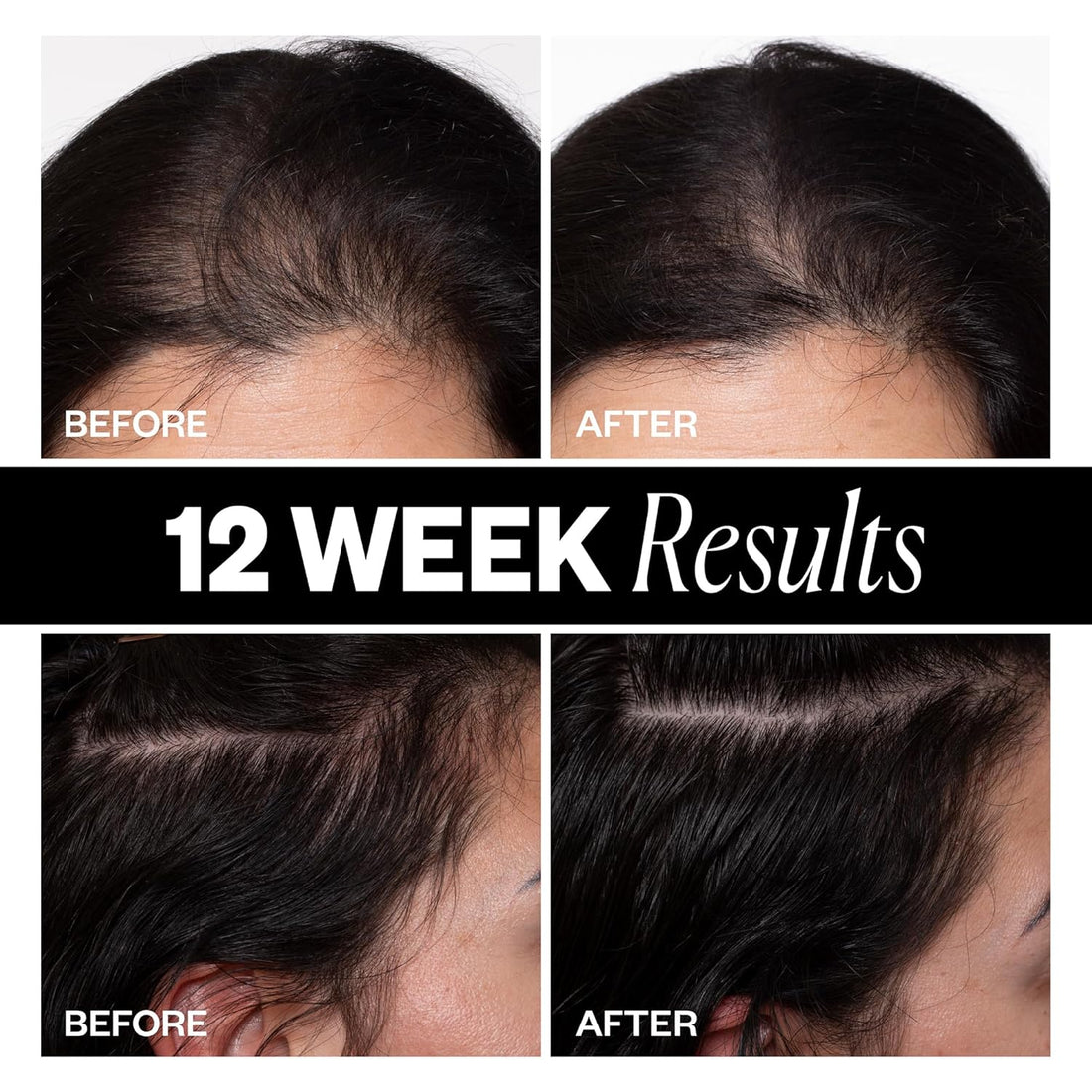 IGK Hair Loss Treatments IGK Sponsored Hair Density Scalp Treatment - Skin Type Solutions