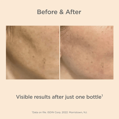 ISDIN Melaclear Advanced Gel-serum