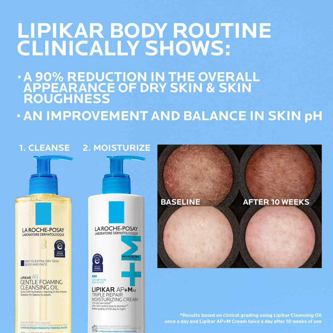 La Roche-Posay Body Moisturizer La Roche-Posay Lipikar AP+Max Triple Repair Moisturizing Cream - Skin Type Solutions