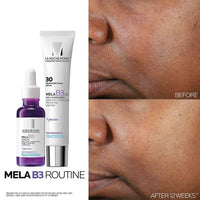 La Roche-Posay Facial Treatment 1.0 fl. oz. La Roche-Posay Mela B3 Dark Spot Serum - Skin Type Solutions