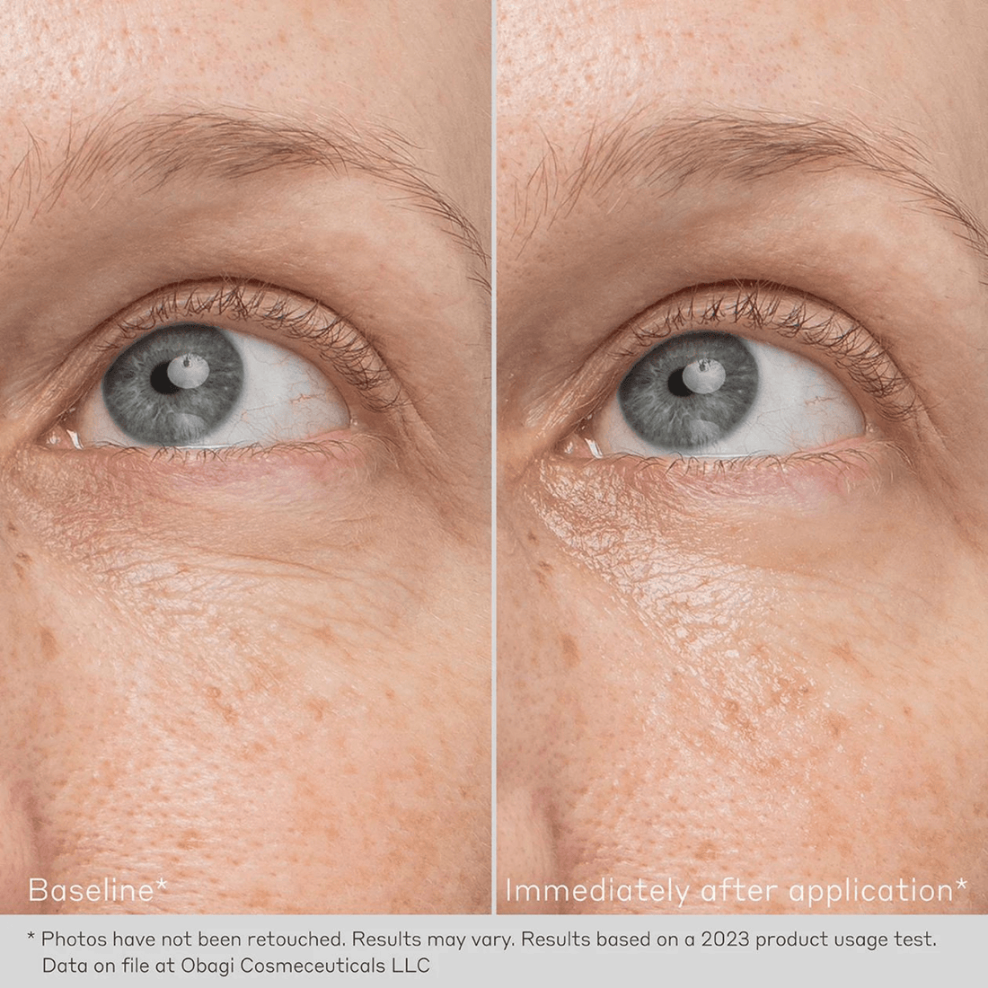Obagi Eye Treatment Creams 0.5 oz. Obagi Daily Hydro-Drops Rejuvenating Eye Gel Cream - Skin Type Solutions
