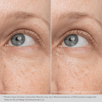 Obagi Eye Treatment Creams 0.5 oz. Obagi Daily Hydro-Drops Rejuvenating Eye Gel Cream - Skin Type Solutions