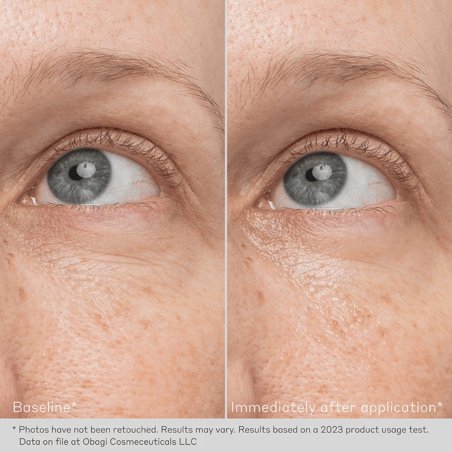 Obagi Eye Treatment Creams 0.5 oz. Obagi Daily Hydro-Drops Rejuvenating Eye Gel Cream - Skin Type Solutions