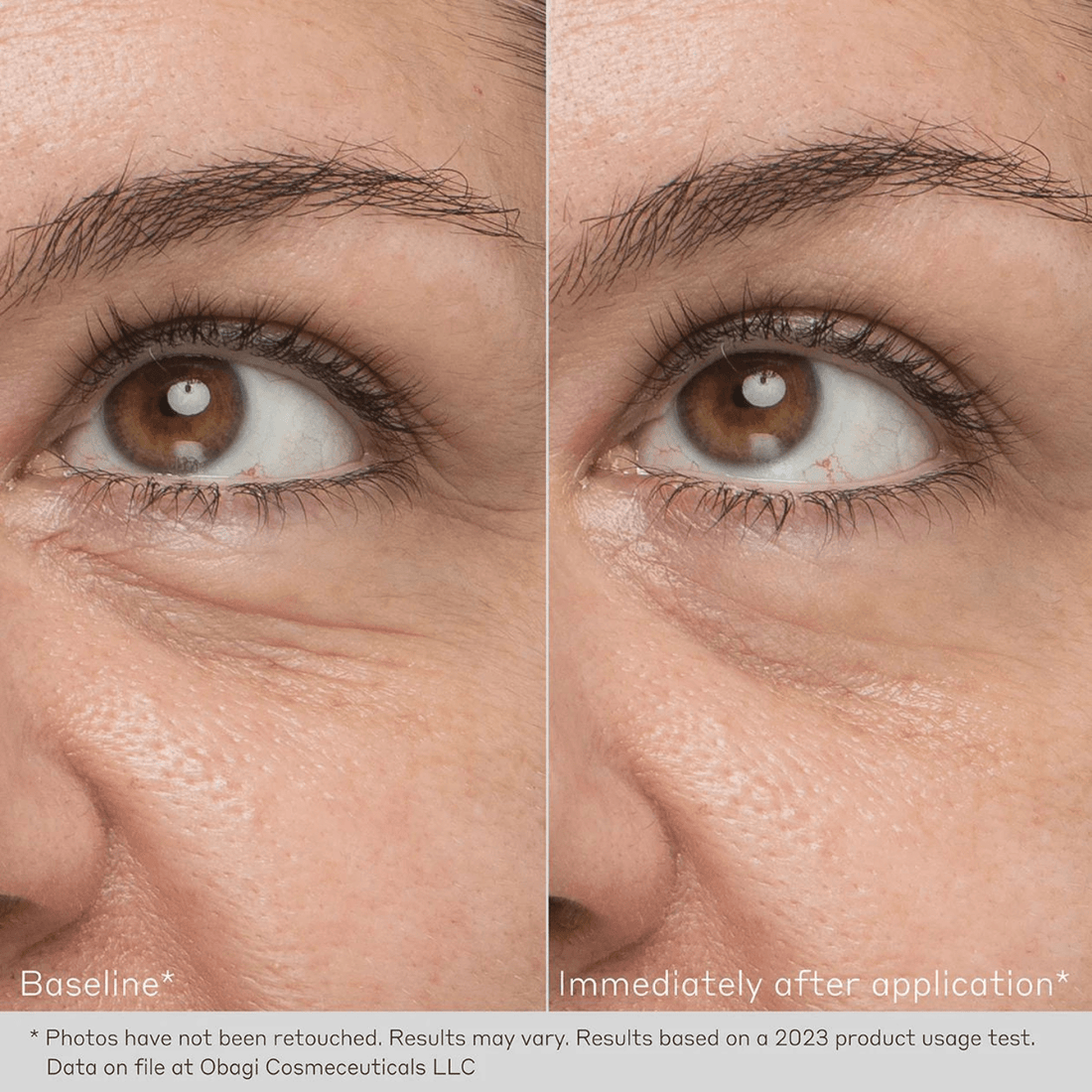 Obagi Eye Treatment Creams 0.5 oz. Obagi Daily Hydro-Drops Rejuvenating Eye Gel Cream - Skin Type Solutions