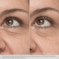 Obagi Eye Treatment Creams 0.5 oz. Obagi Daily Hydro-Drops Rejuvenating Eye Gel Cream - Skin Type Solutions