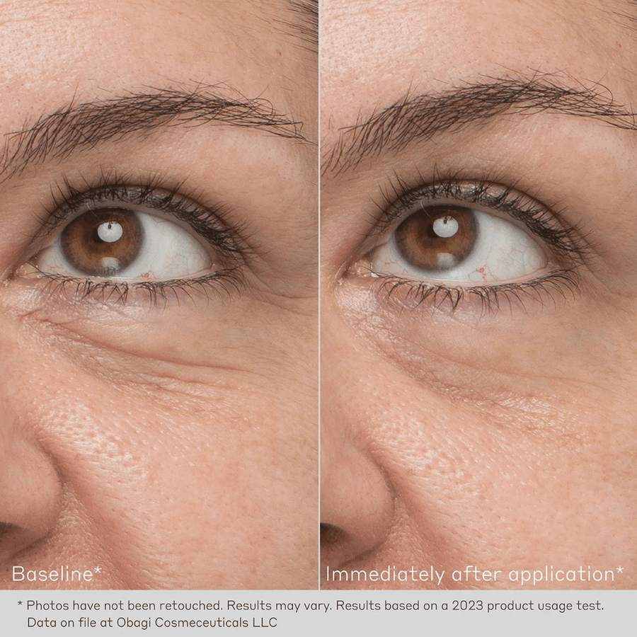 Obagi Eye Treatment Creams 0.5 oz. Obagi Daily Hydro-Drops Rejuvenating Eye Gel Cream - Skin Type Solutions