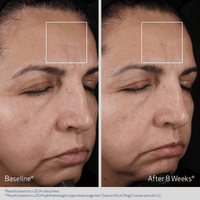 Obagi 0.68 fl. oz. Obagi ELASTIderm Advanced Filler Concentrate - Skin Type Solutions