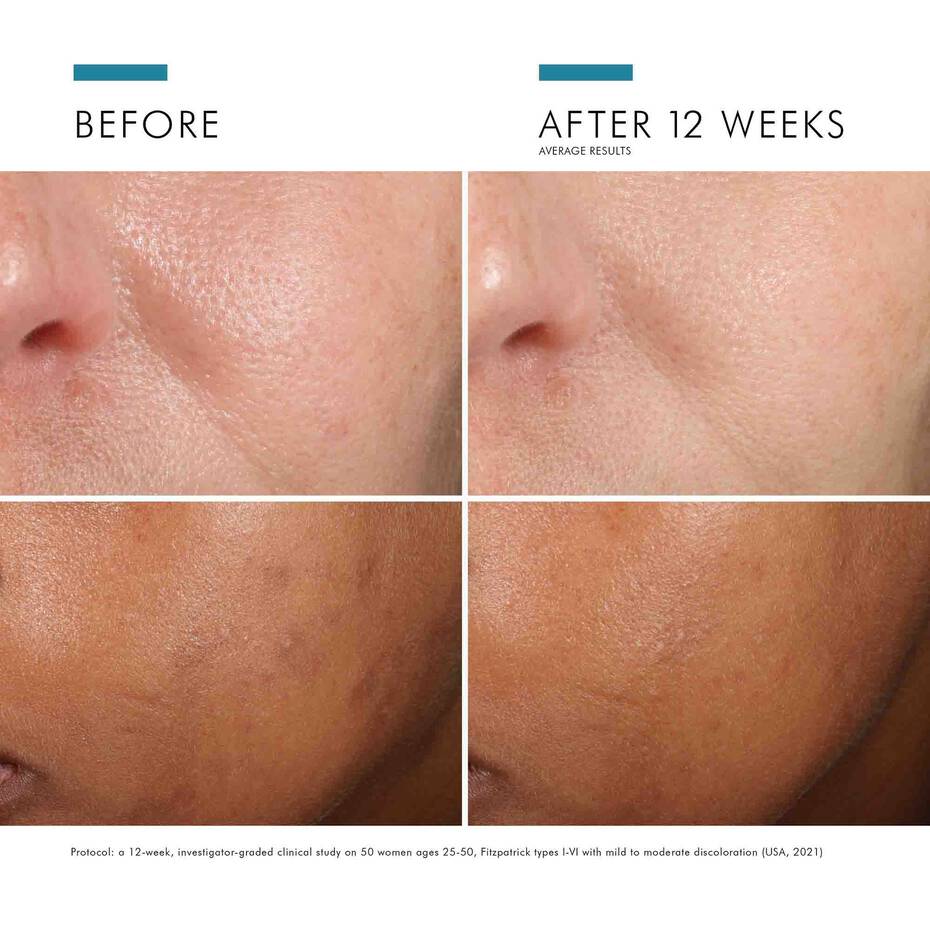 SkinCeuticals Phloretin CF – Skin Type Solutions