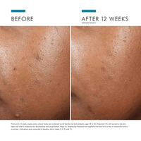 SkinCeuticals Facial Treatment 1 fl. oz. SkinCeuticals Phyto A+ Brightening Treatment Daily Corrective Moisturizer - Skin Type Solutions