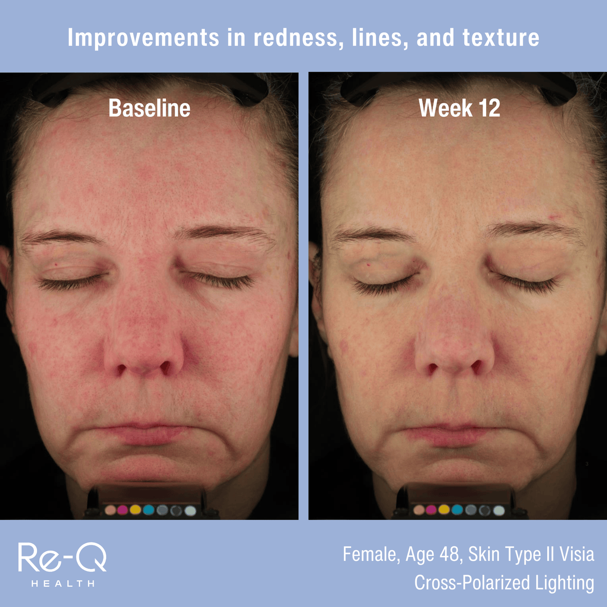ReQ Treatments & Serums Re-Q Pro-Longevity Face Serum - Skin Type Solutions