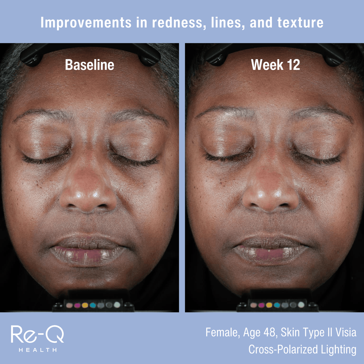 ReQ Treatments & Serums Re-Q Pro-Longevity Face Serum - Skin Type Solutions