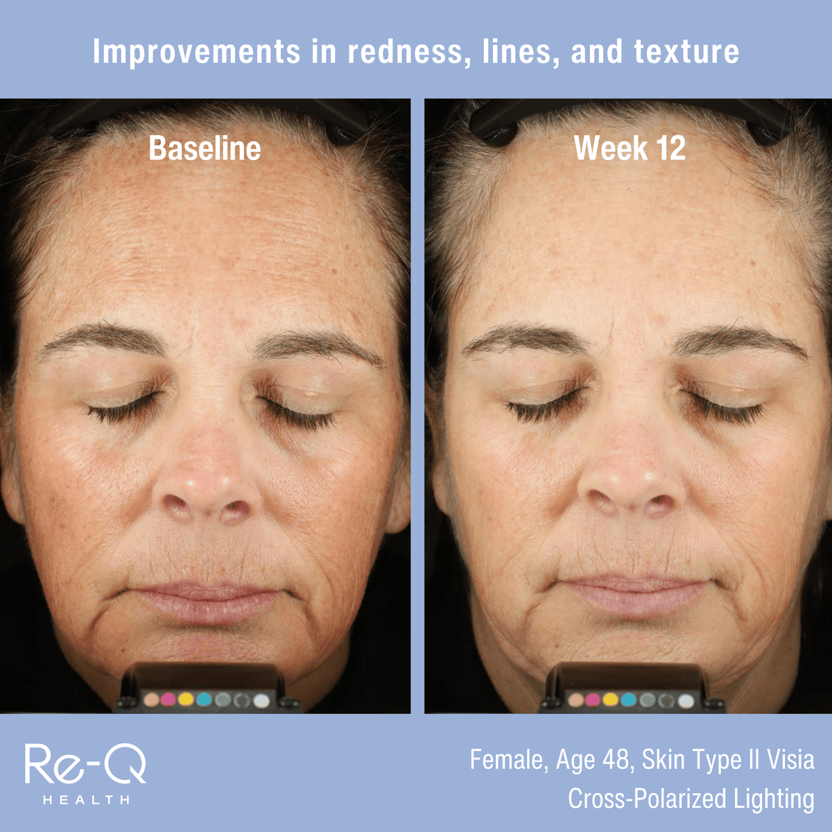 ReQ Treatments & Serums Re-Q Pro-Longevity Face Serum - Skin Type Solutions