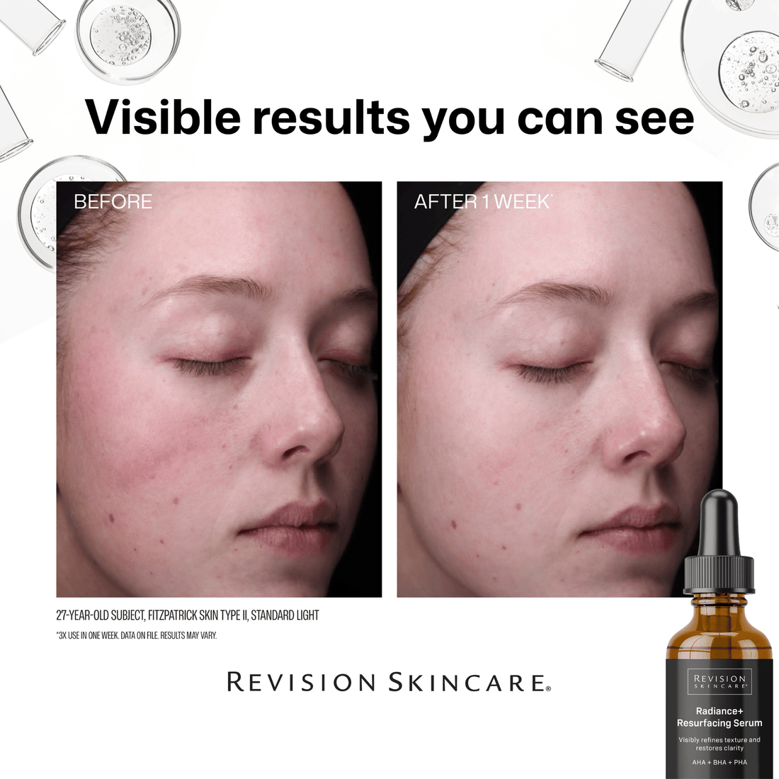 Revision Treatments & Serums Revision Skincare Radiance+ Resurfacing Serum - Skin Type Solutions