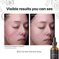 Revision Treatments & Serums Revision Skincare Radiance+ Resurfacing Serum - Skin Type Solutions